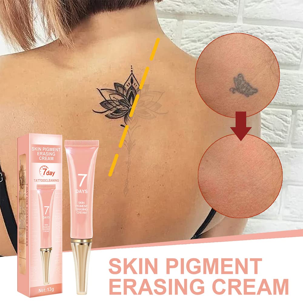 KlsyChry Tattoo Removal Cream — Fast, Painless Ink Erasure