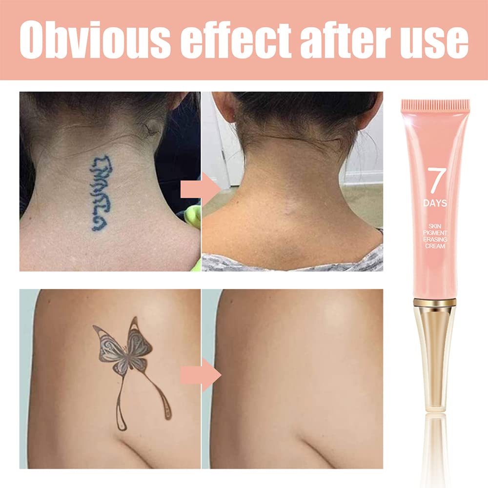 KlsyChry Tattoo Removal Cream — Fast, Painless Ink Erasure