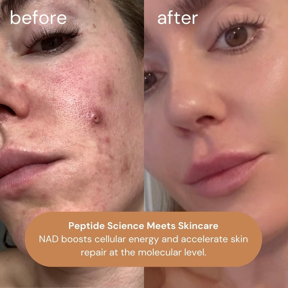 KOA LIFE NAD Peptide Facial Daily Anti-Aging Serum | Copper Bottle