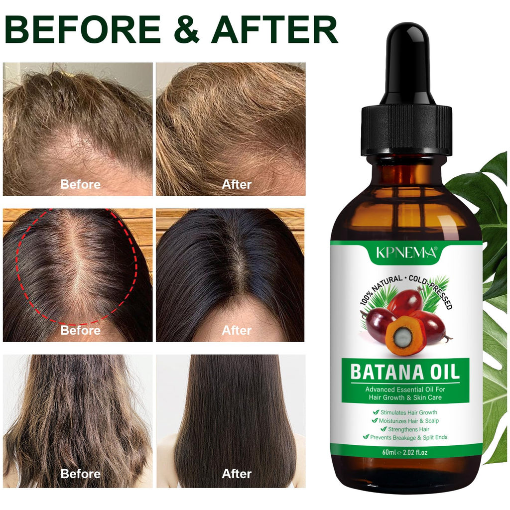 KPNEMA Batana Oil for Hair Growth – 2 Pack, 100% Pure Organic Hair & Skin Care