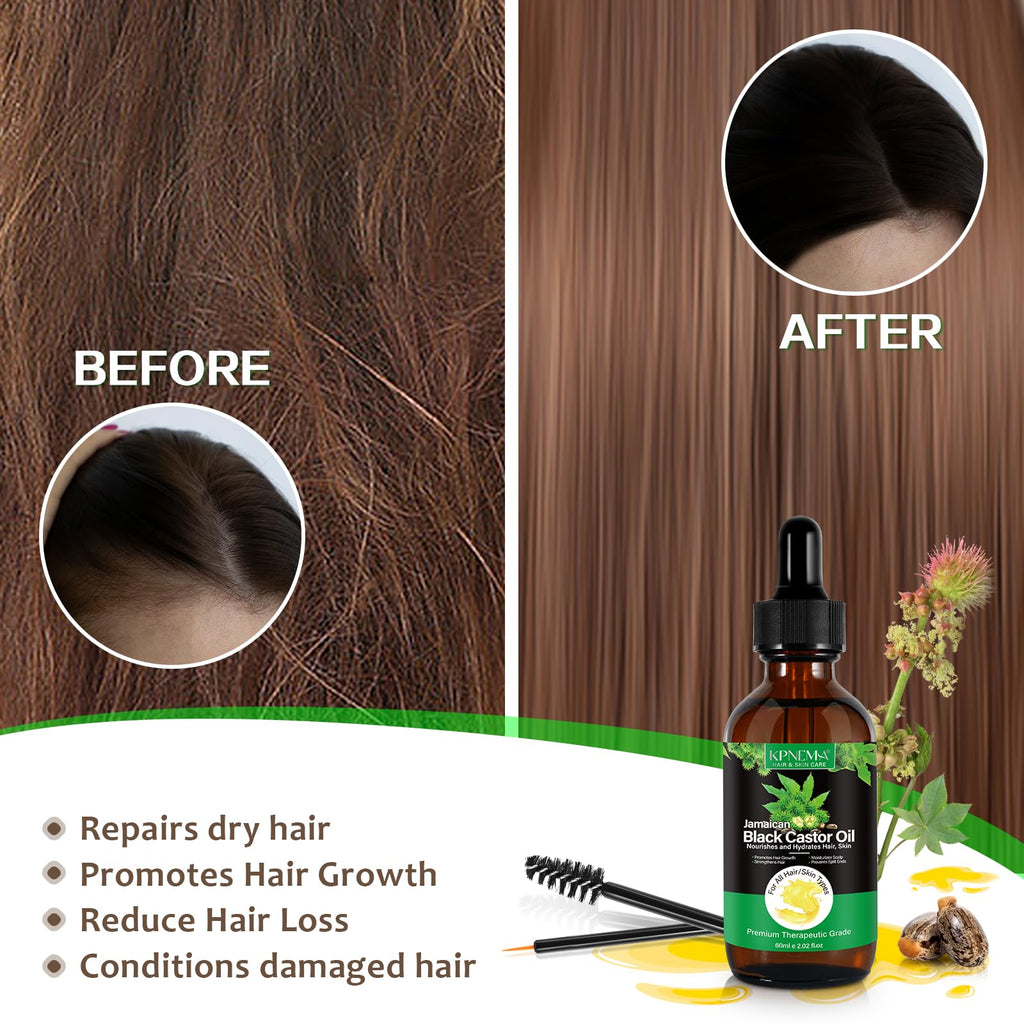 KPNEMA Jamaican Black Castor Oil for Hair Growth – 2 Pack, Cold Pressed & 100% Natural