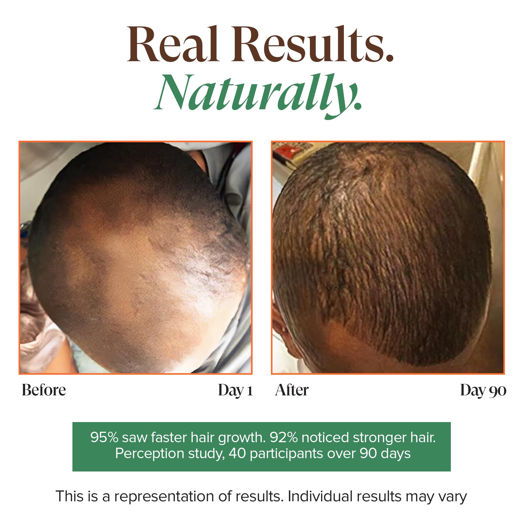 KREYÒL ESSENCE Haitian Black Castor Oil for Skin & Hair – Cold Pressed, Hexane Free, Mango Papaya & Coconut, 3.4 fl oz