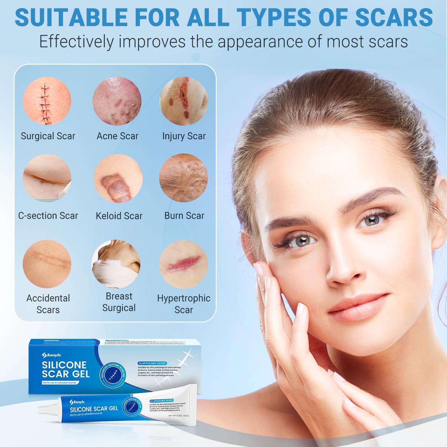 Kunyle Silicone Scar Gel 0.70oz — Advanced Scar Cream for Surgical Scars, Stretch Marks & Keloids
