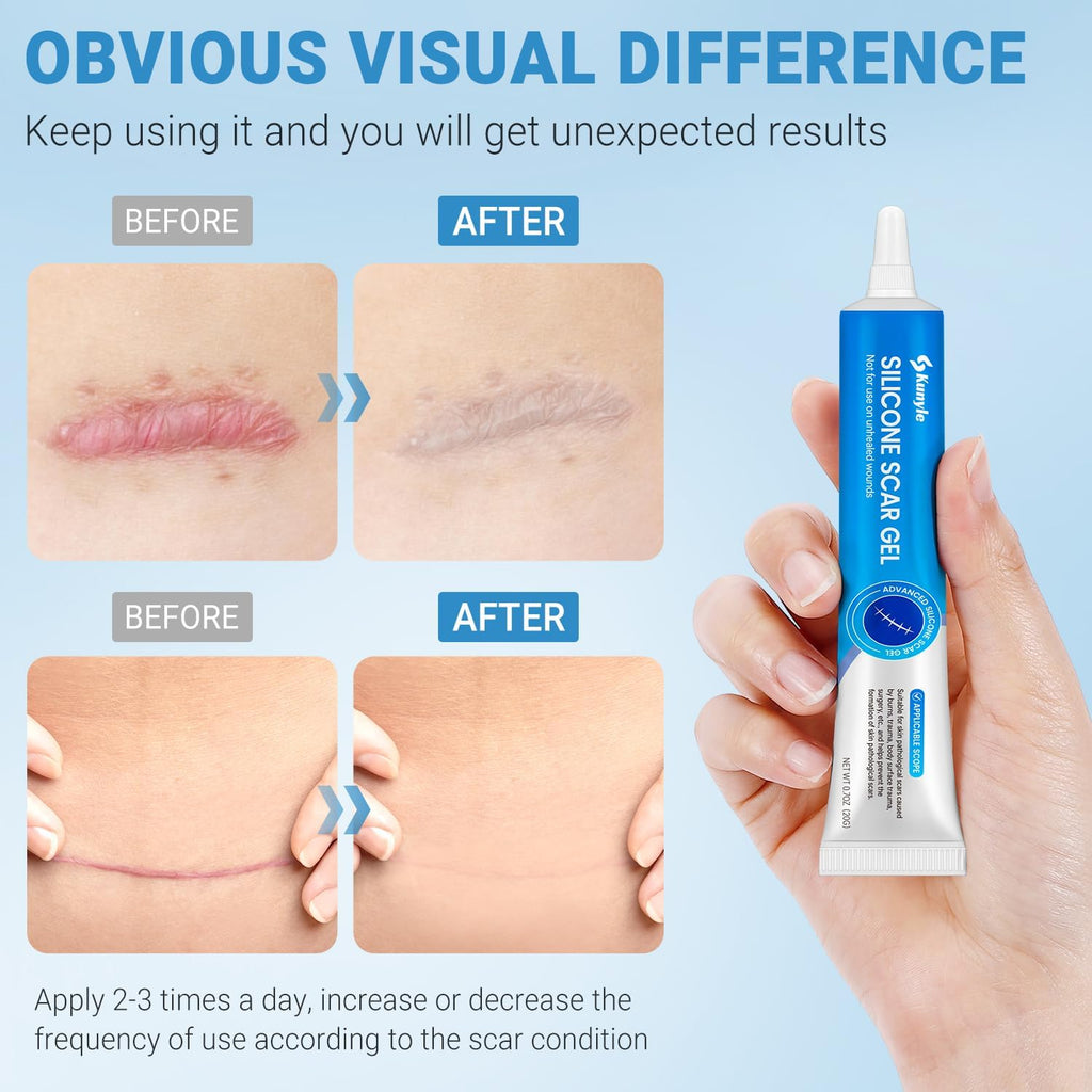 Kunyle Silicone Scar Gel 0.70oz — Advanced Scar Cream for Surgical Scars, Stretch Marks & Keloids