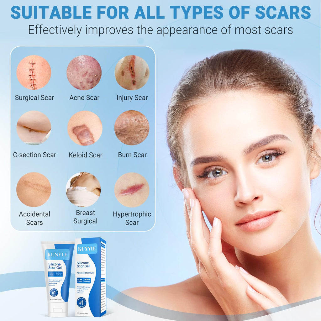 Kunyle Silicone Scar Gel – Advanced Scar Cream for Surgical Scars, Stretch Marks & Keloids | 2.11oz