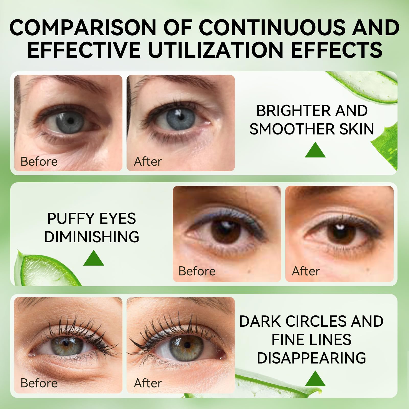 LANBENA Aloe Vera Under Eye Patches – Hydration, Brightening & Puffiness Reduction (30 Pairs)