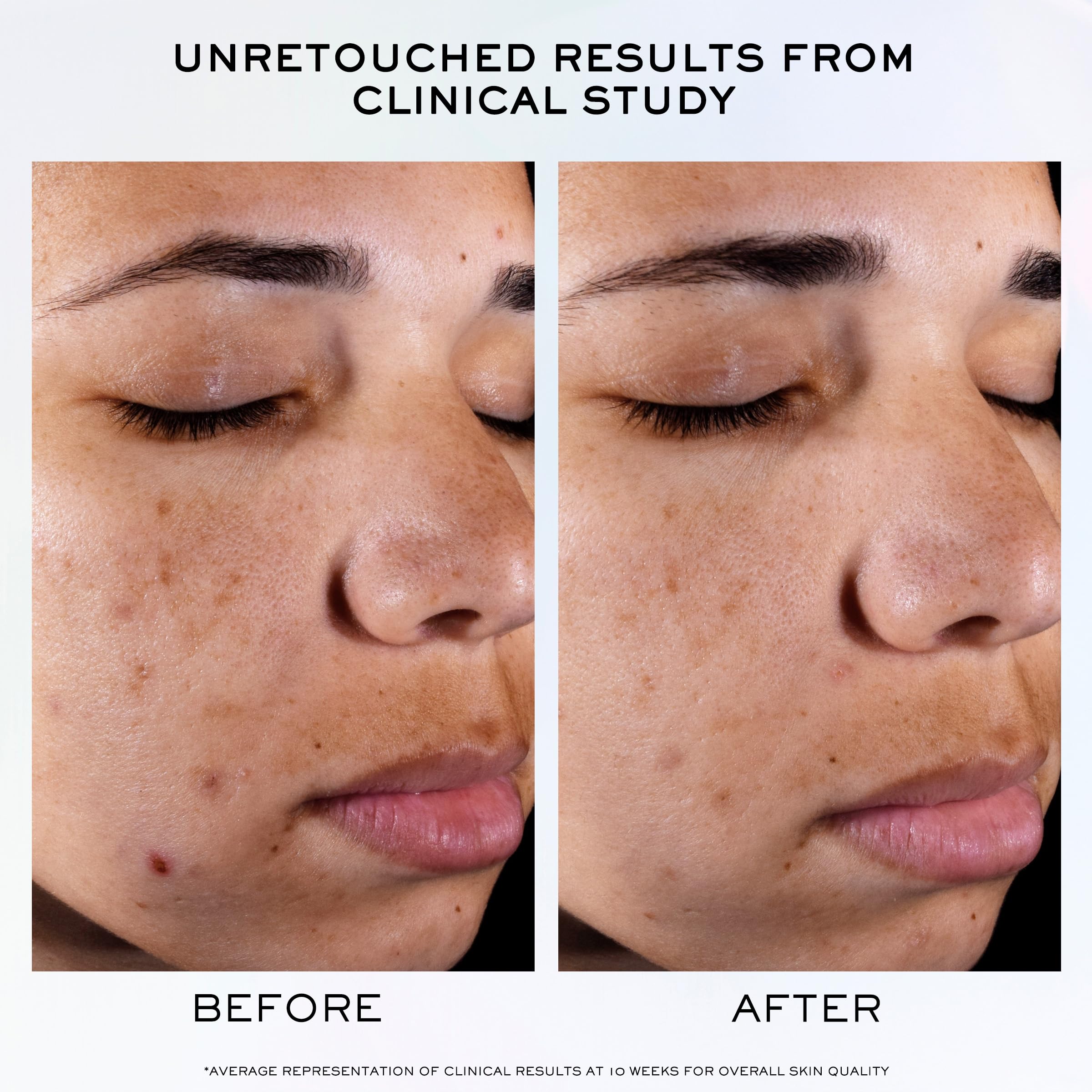 Lancôme Clarifique Pro-Solution Serum – Brighten Dark Spots & Refine Pores | 10% PHA + Niacinamide