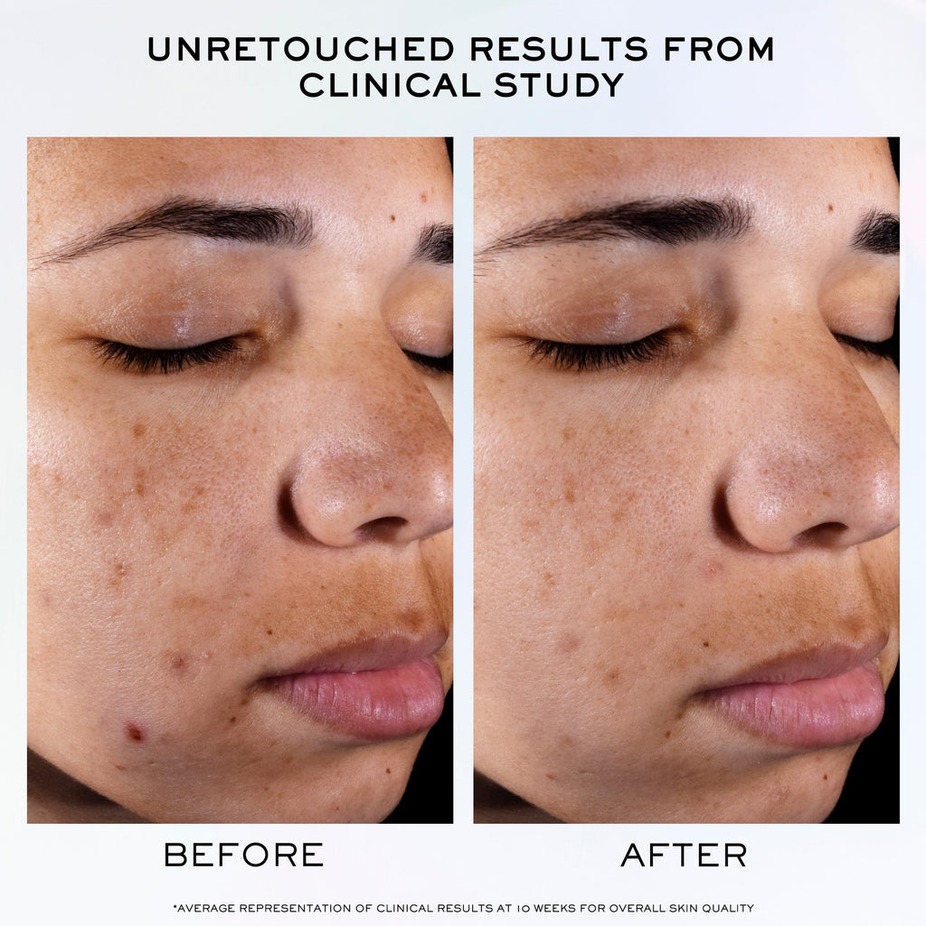 Lancôme Clarifique Pro-Solution Serum – 10% PHA + Niacinamide | Dark Spot & Post-Acne Brightening | 1.7 Fl Oz