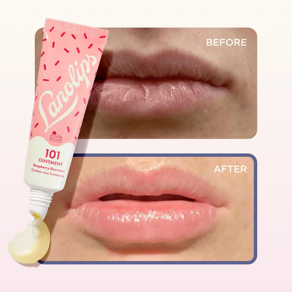 Lanolips 101 Ointment Raspberry Shortcake – Hydrating Lip Balm & Multi-Balm (0.52 oz)