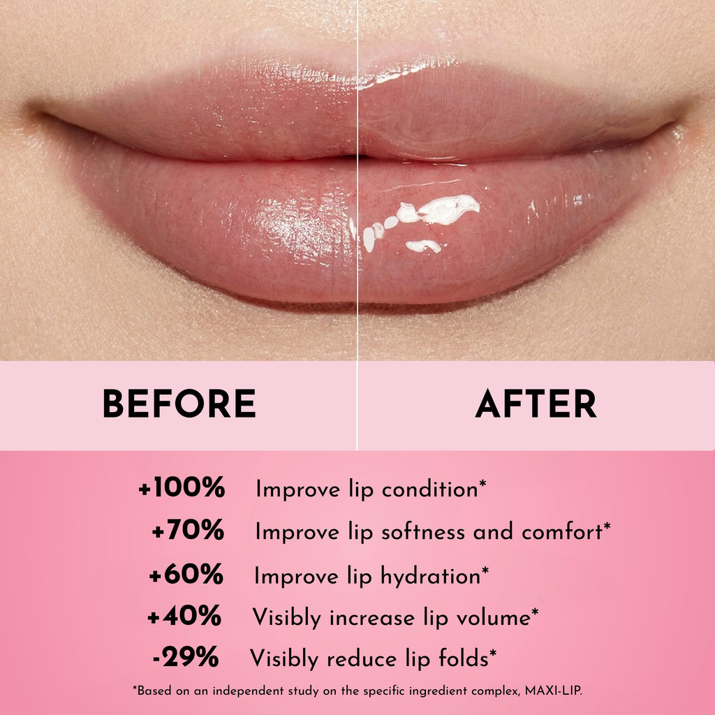 Lawless Forget The Filler Lip Plumper Line Gloss Rosy Outlook Pink 0.11 Fl Oz (Pack of 1)