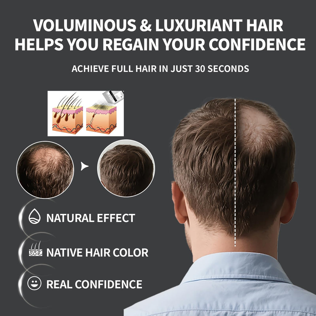 LEWEDO Hair Building Fibers Refill Pack 100g – Instant Thickening for Men & Women (Medium Brown)