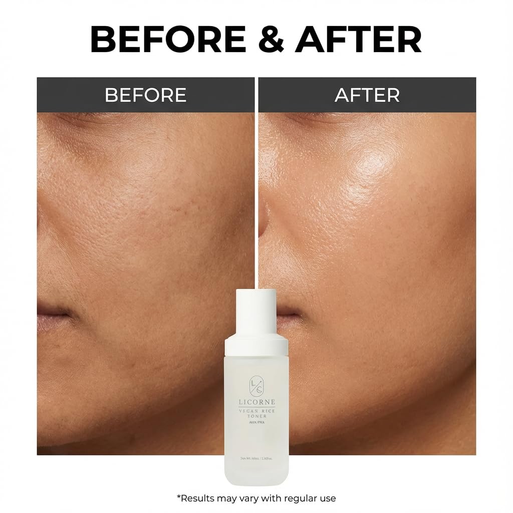LICORNE Vegan Rice Toner — Gentle AHA/PHA Exfoliation for Glass Skin