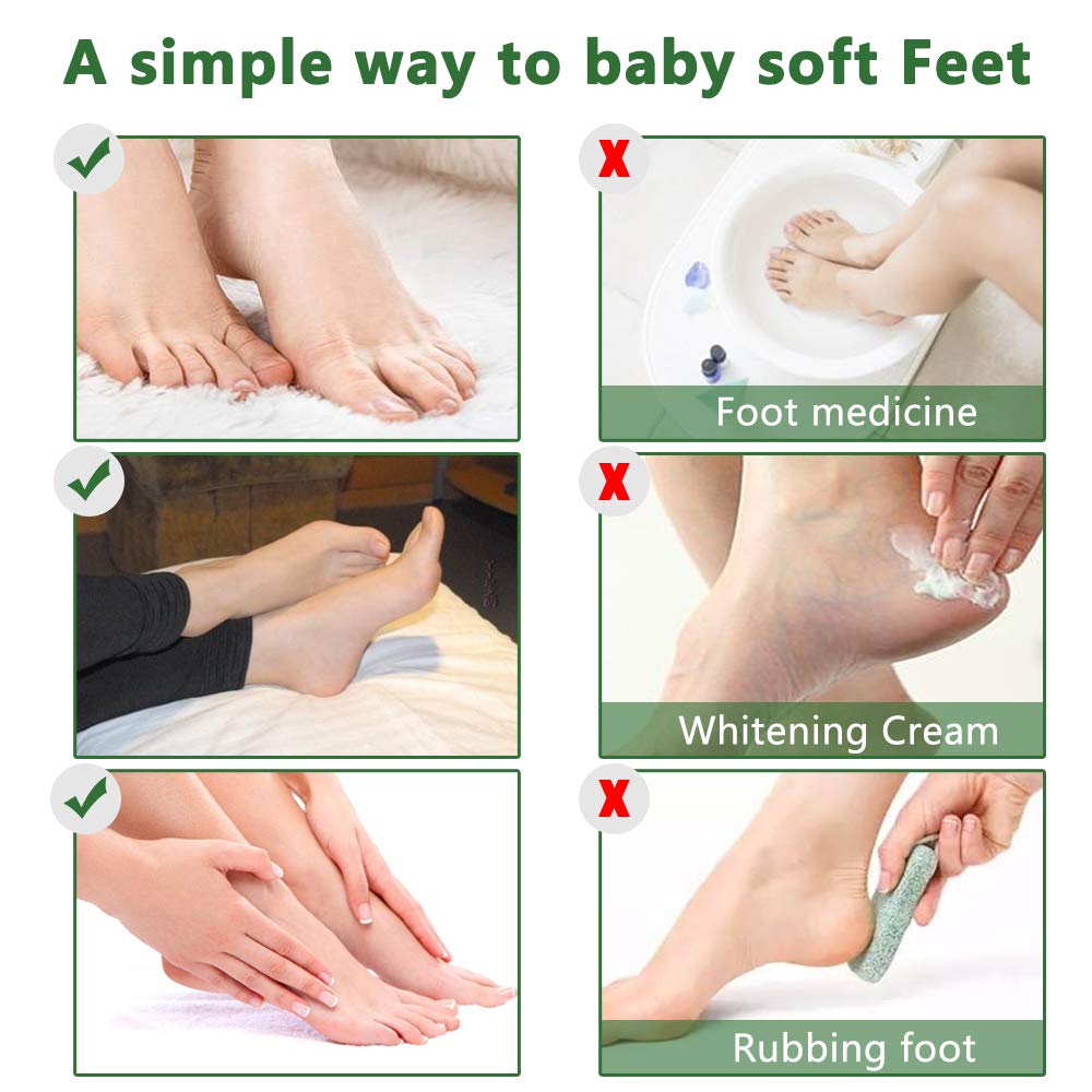 Liefiet Foot Peeling Mask 5 Pack – Lavender-Infused Exfoliating Socks for Soft Feet