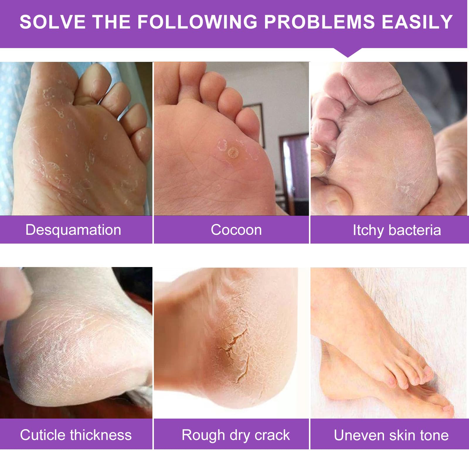 Liefiet Lavender Foot Peeling Mask 5 Pack – Exfoliate, Hydrate, Soft Feet