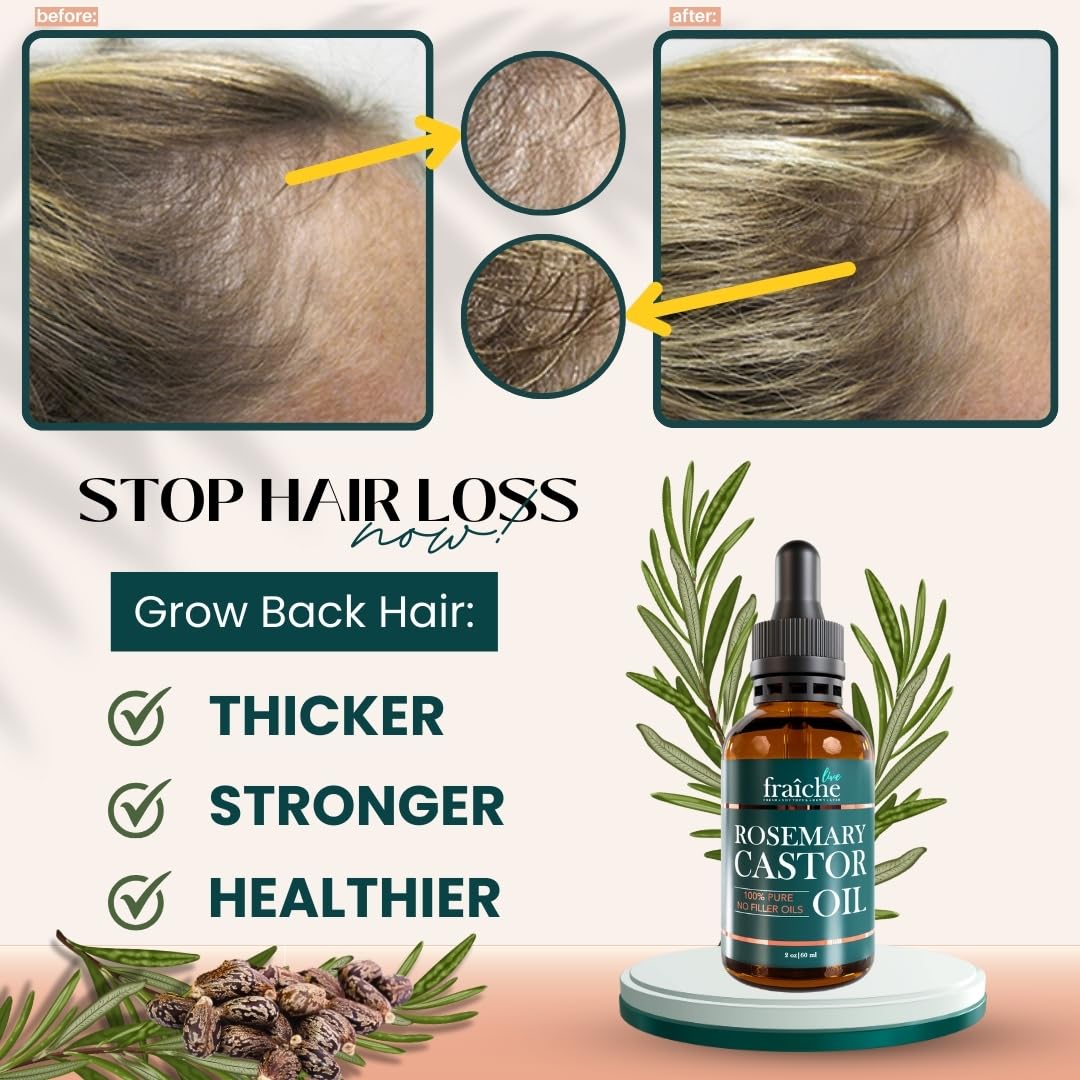 Live Fraiche Rosemary Oil for Hair Growth – 2oz with Cold-Pressed Castor Oil