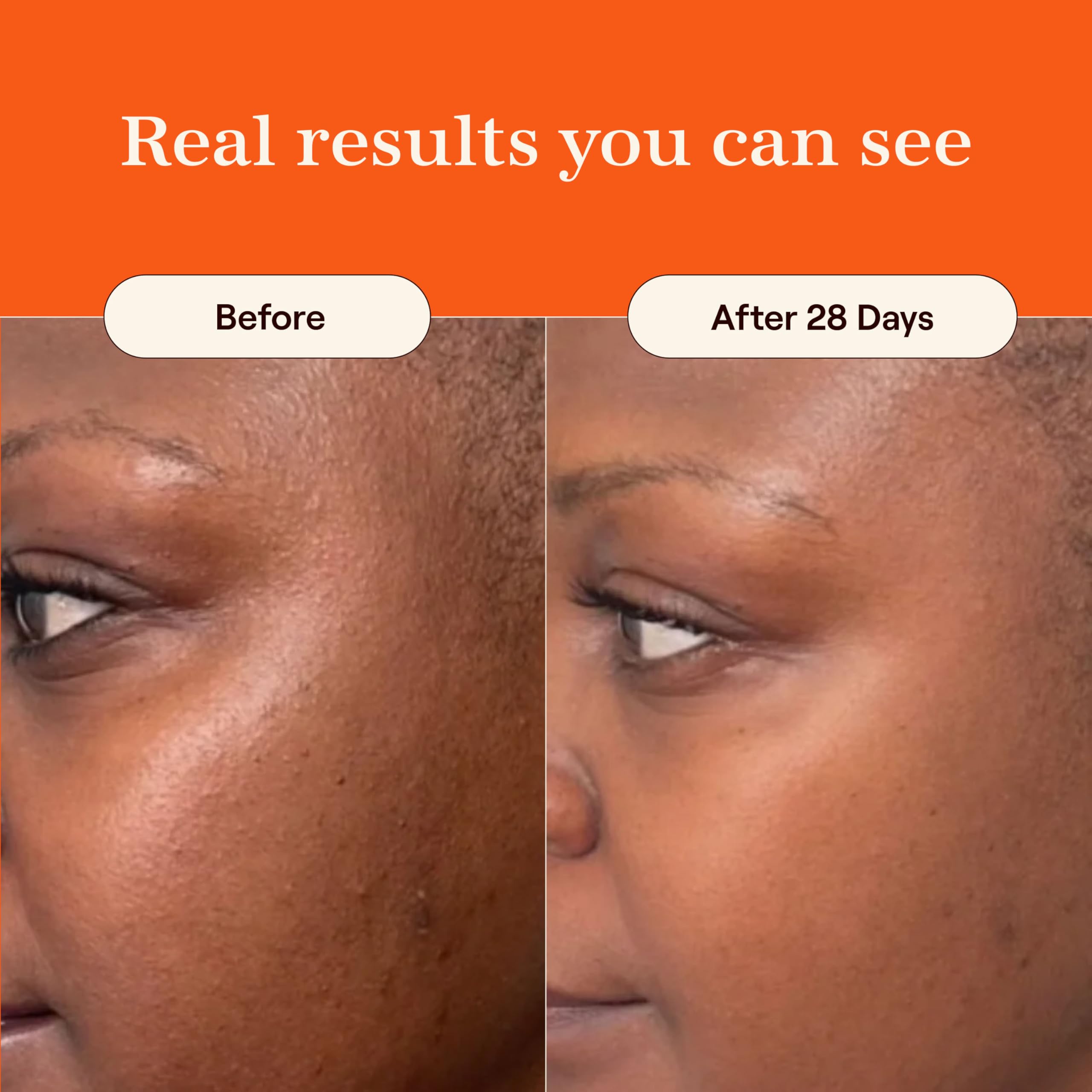 Live Tinted Superhue Hyperpigmentation Serum Stick – Balm-to-Serum for Face & Body