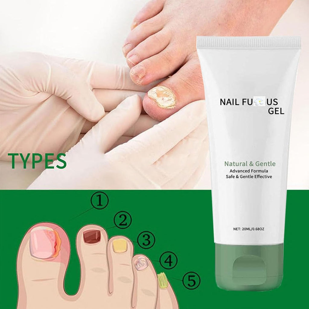 Lmoy 2PCS Nail Repair Gel & Nail Growth Cream – Multi-Purpose Nail Care