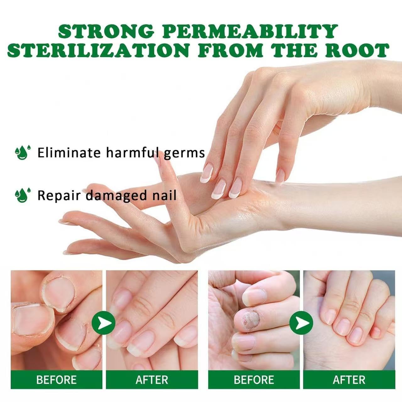 Lmoy 2PCS Nail Repair Gel & Nail Growth Cream – Multi-Purpose Nail Care