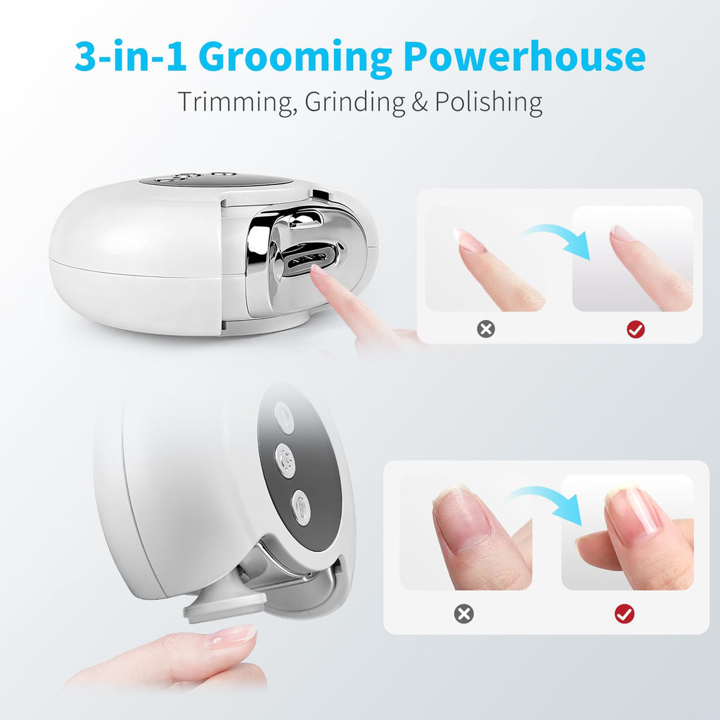 Lucidora 3-in-1 Electric Nail Clipper – Safe Trim, LED Light, Rechargeable