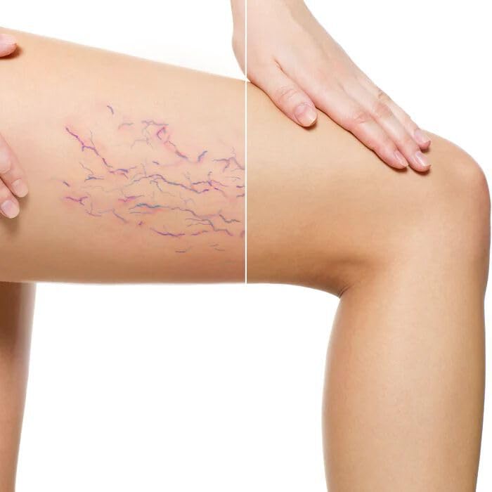 LUMINESS Airbrush Body Coverage – Tattoo Cover Up Foundation (Water-Resistant, Long-Wear, Warm)