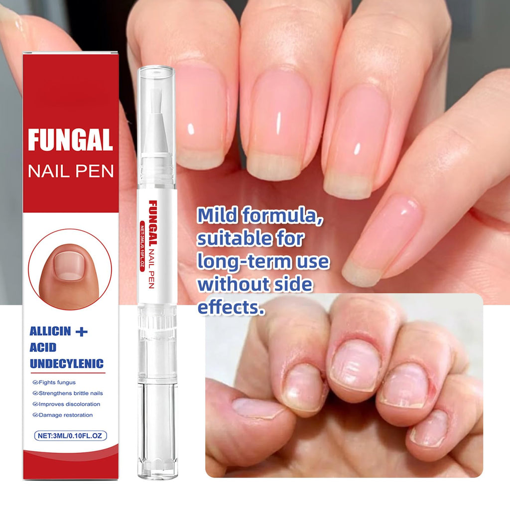 Lumzist Fungal Nail Renewal Pen (2-Pack) – Restore Color, Strength & Clarity