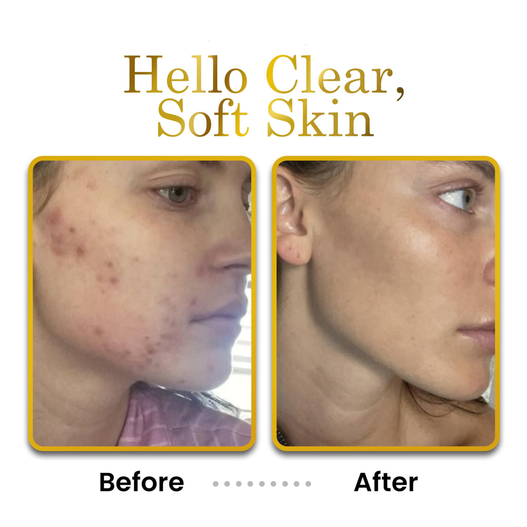 LUXELOTION Non-Greasy Moisturizer for Face, Neck & Hands | Coconut-Scented Hyaluronic Acid Lotion by LUXEBEAUTY
