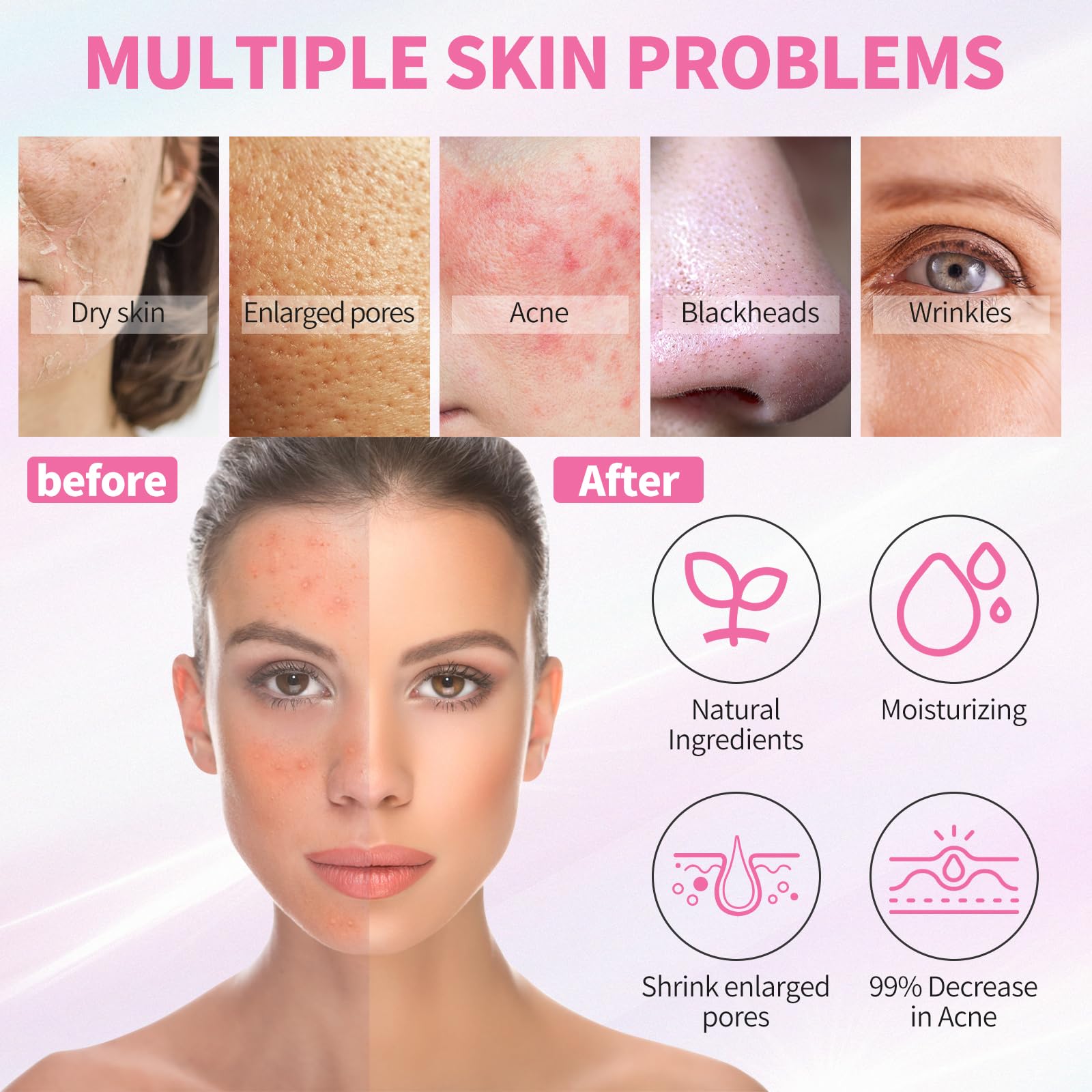 LXSKN Daily Acne Essentials Kit – 5-Step Skincare for Clearer Skin