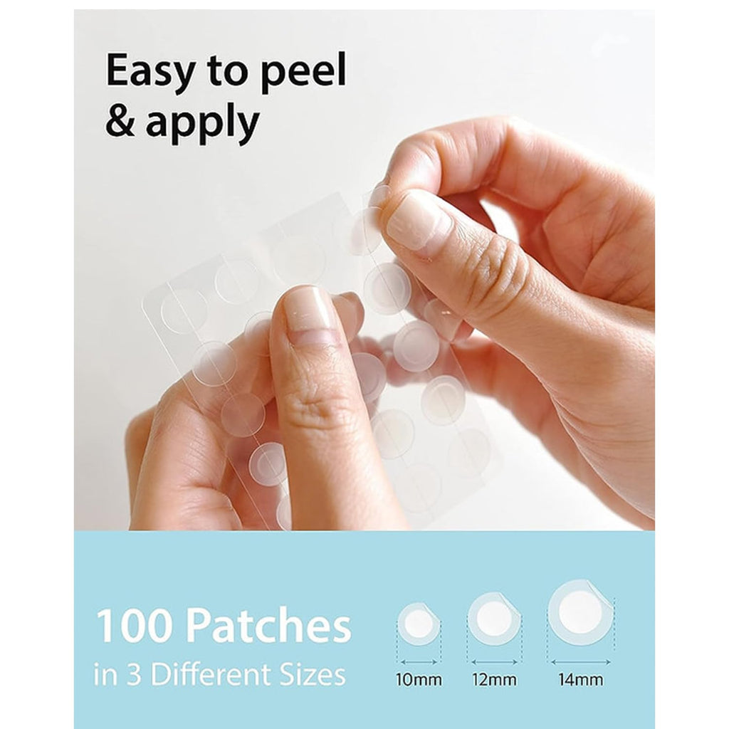 Madeca Derma Ready Cure Patch Original – Hydrocolloid Acne Patches (100 Patches, 10/12/14mm, Large Pack)