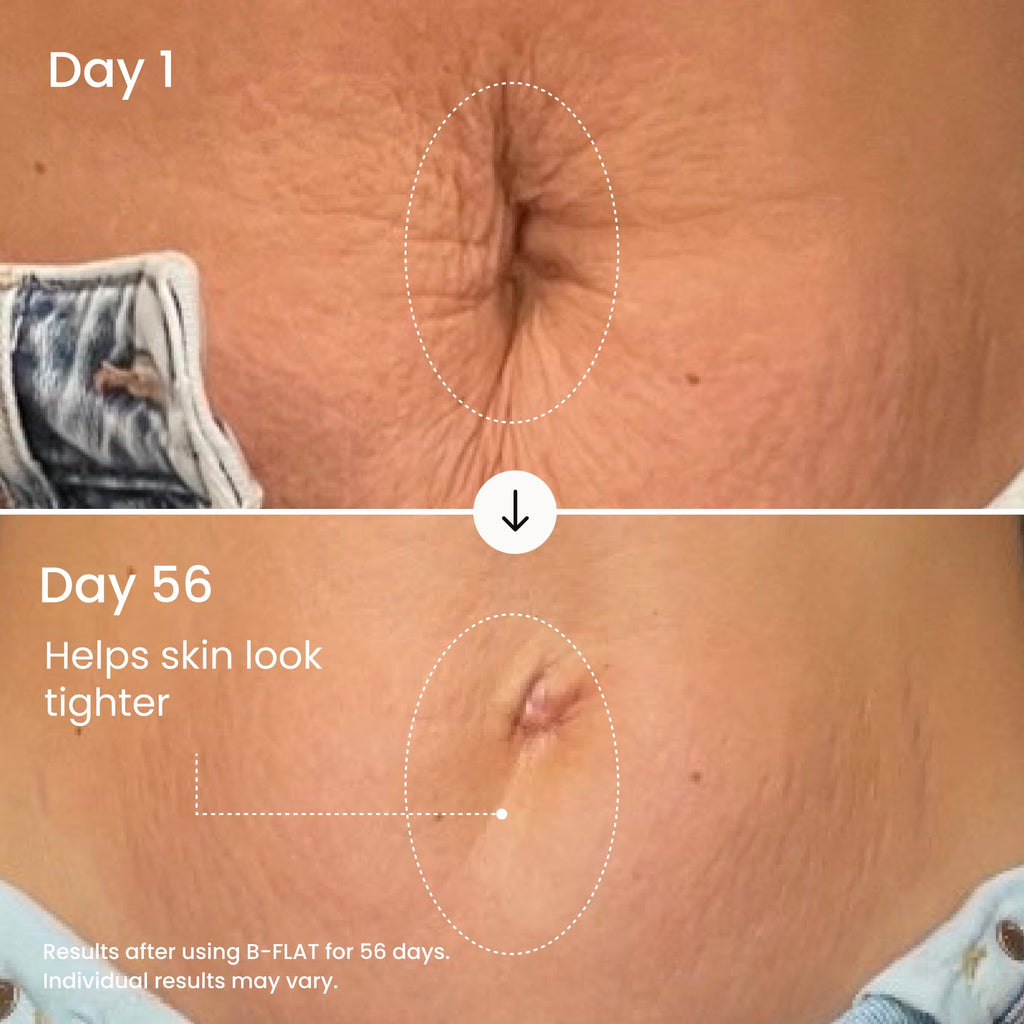 MAËLYS B-FLAT Belly Firming Cream - Postpartum Skin Tightening & Moisturizing (3.4 Fl Oz)