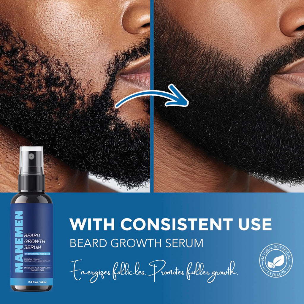 MANEMEN Beard Growth Serum Spray - Biotin, Castor Oil & Vitamins B5/B12