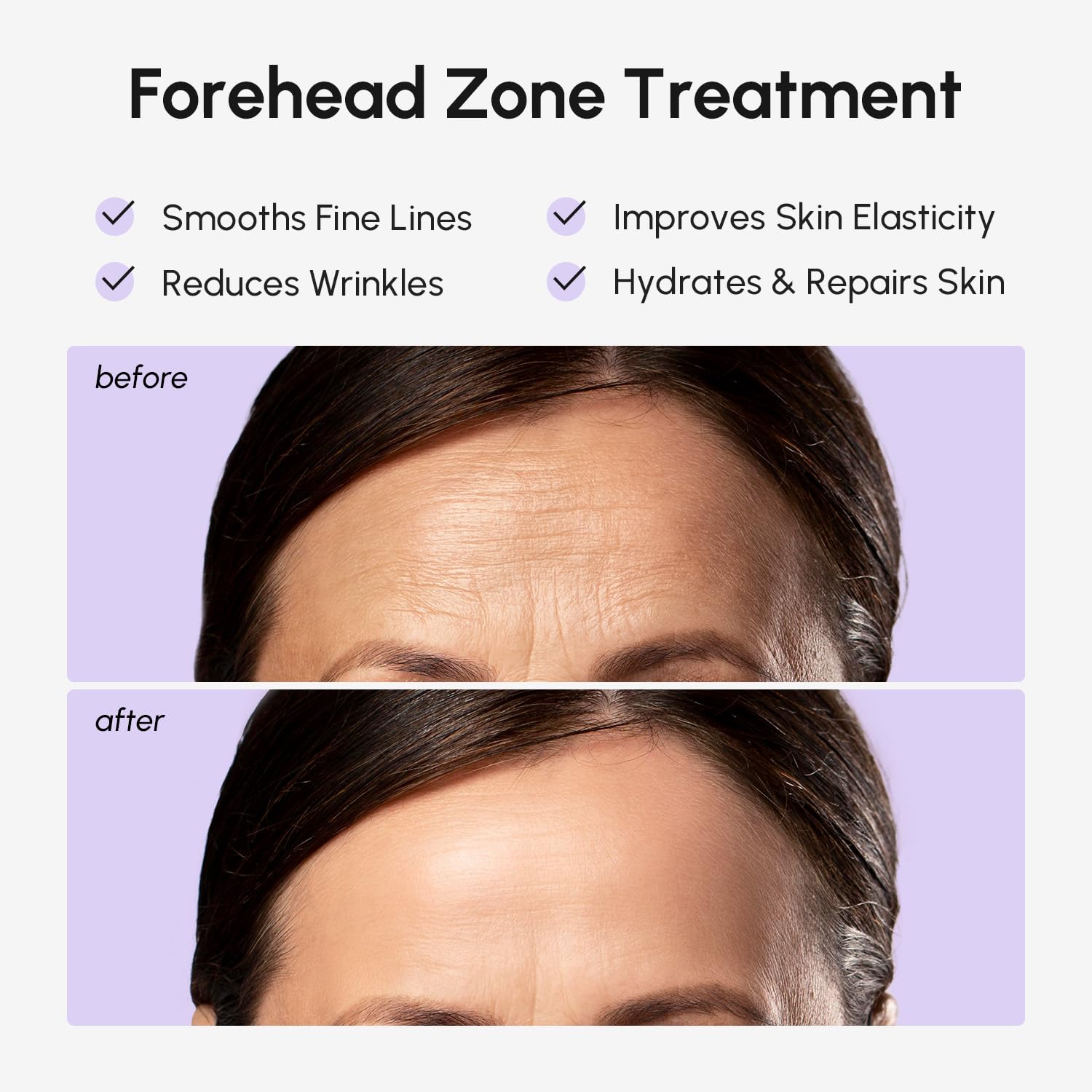 MAREE Forehead Wrinkle Patches – Collagen, Retinol & Hyaluronic Acid for 30-Minute Smoothing