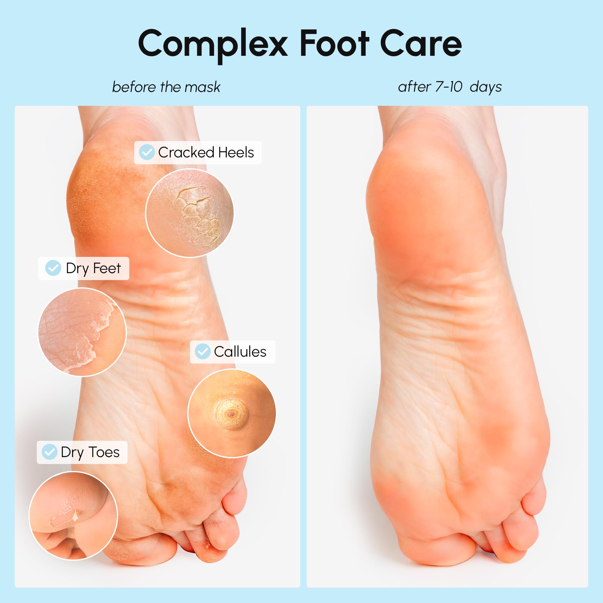 MAREE Foot Peeling Mask – 3-in-1 Exfoliating Socks for Dry Feet