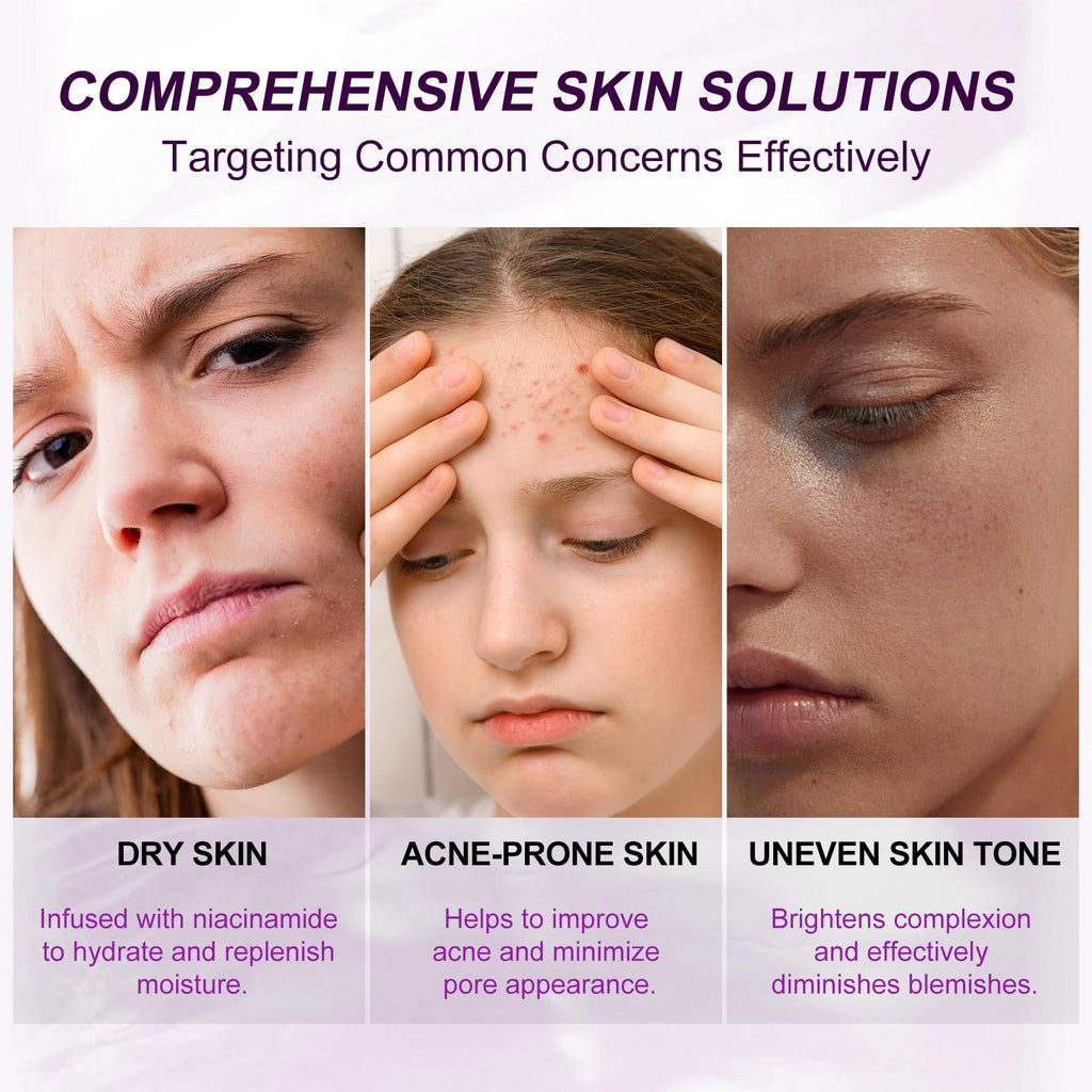 Marianp Hyaluronic Acid Serum with 10% Azelaic Acid – Hydration & Gentle Acne Support