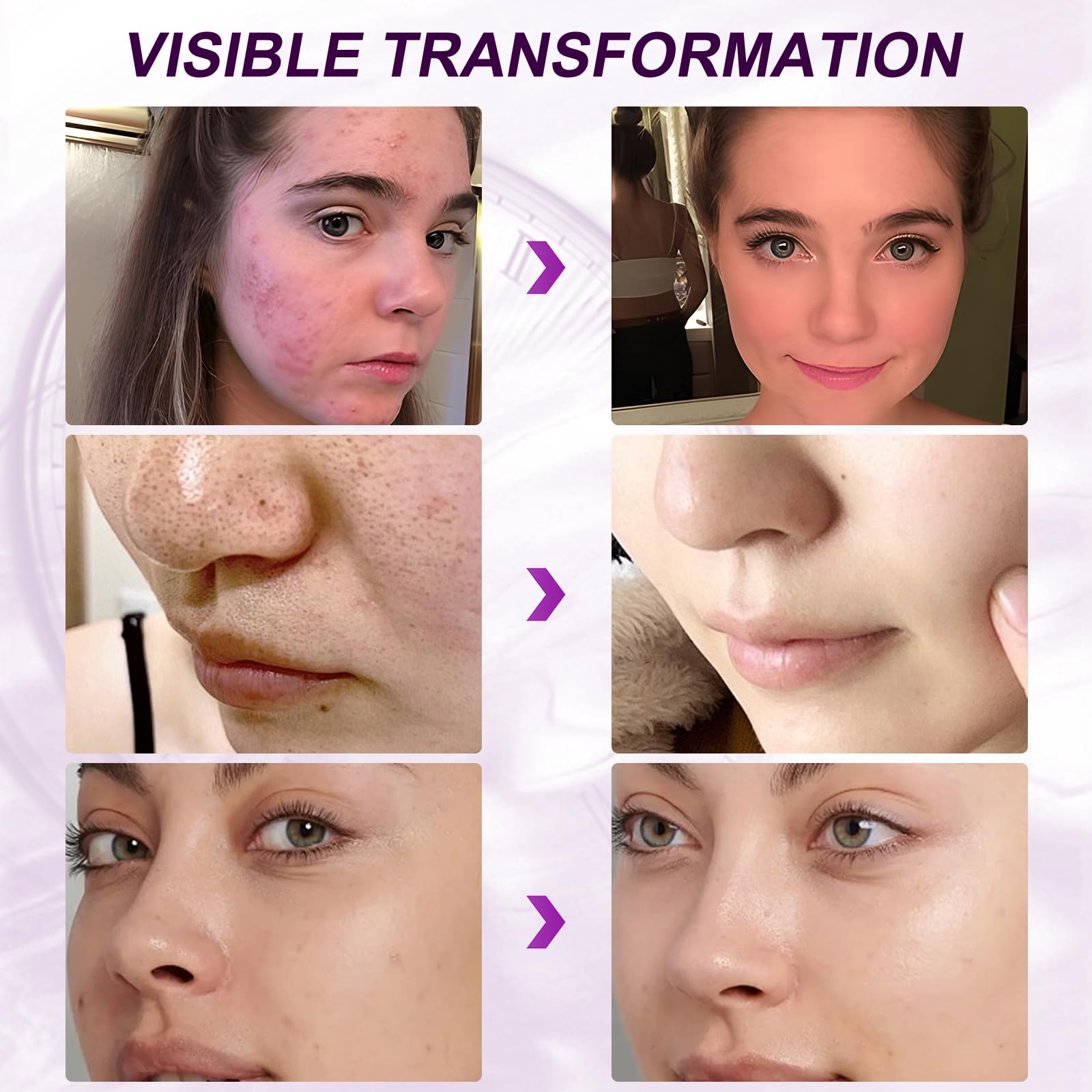Marianp Hyaluronic Acid Serum with 10% Azelaic Acid – Hydration & Gentle Acne Support