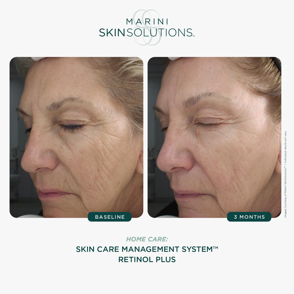 Marini SkinSolutions Retinol Plus – Anti-Aging Cream with Peptides, Antioxidants & Hyaluronic Acid (USA Made)