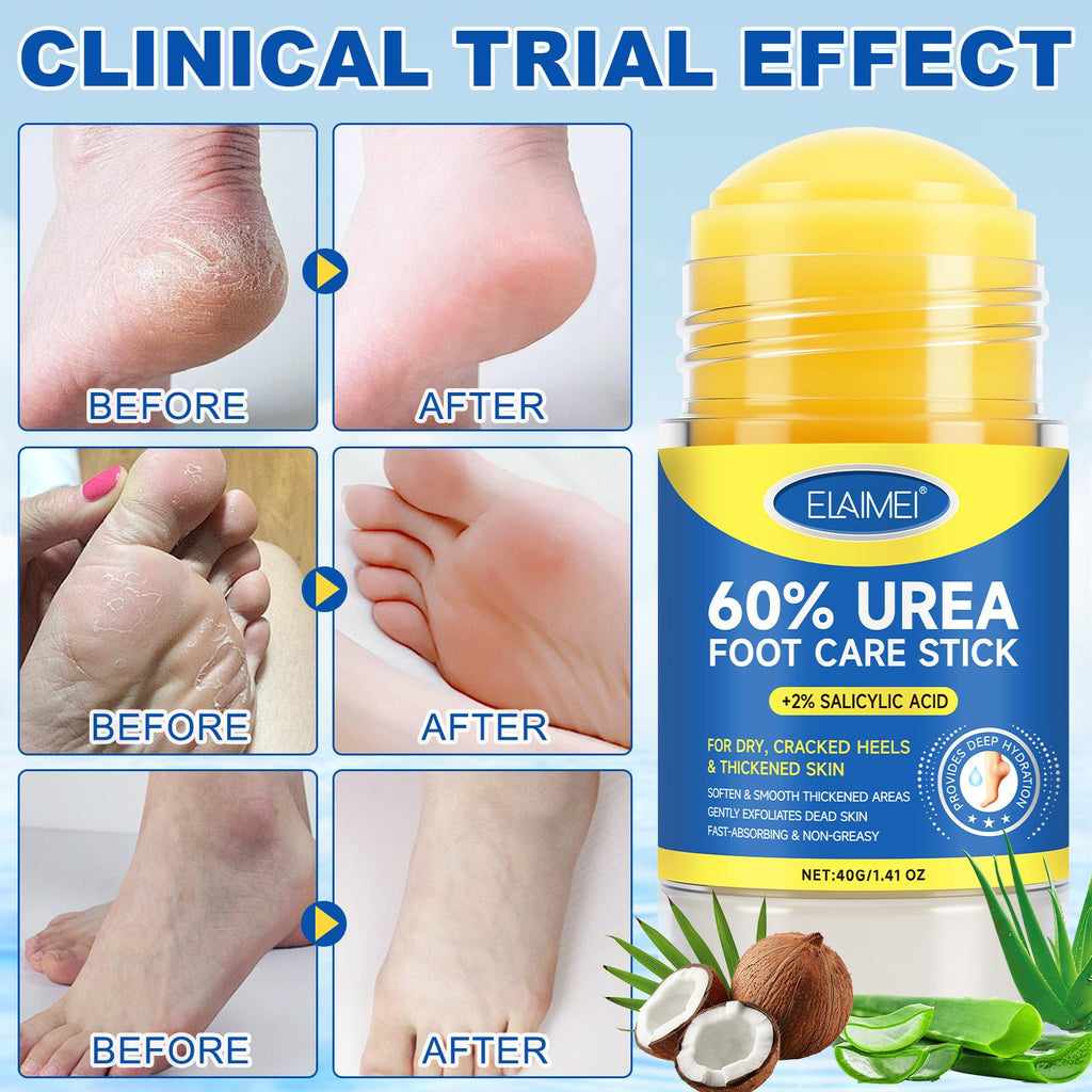 Mcukv Urea Cream Stick 60% + 2% Salicylic Acid – 2 Pack for Dry Heels, Callus Removal & Hydration