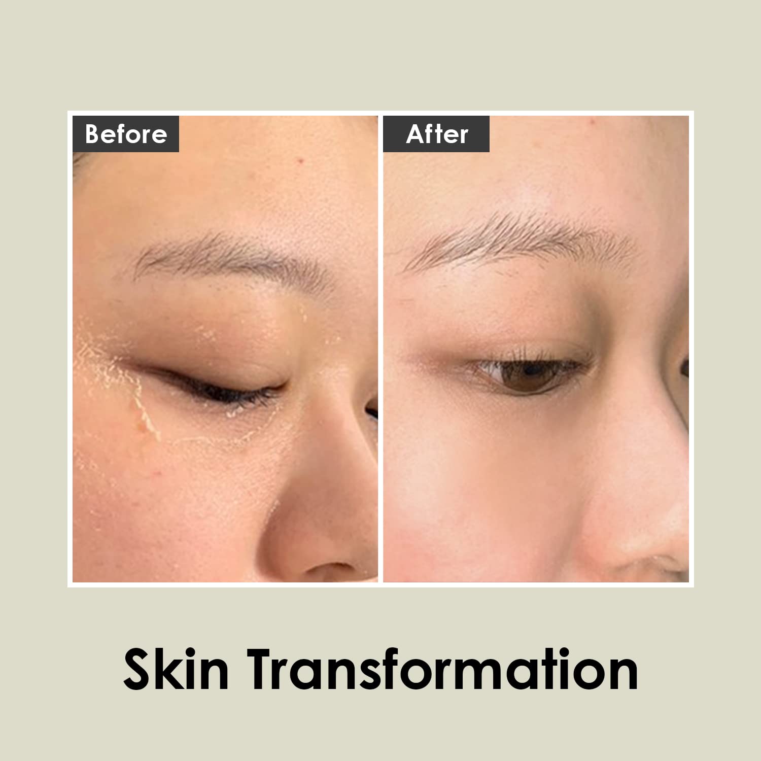 MEDI-PEEL Herbal Peel Tox - Exfoliating Wash-Off Cleanser | Vegan Korean Skincare for All Skin Types