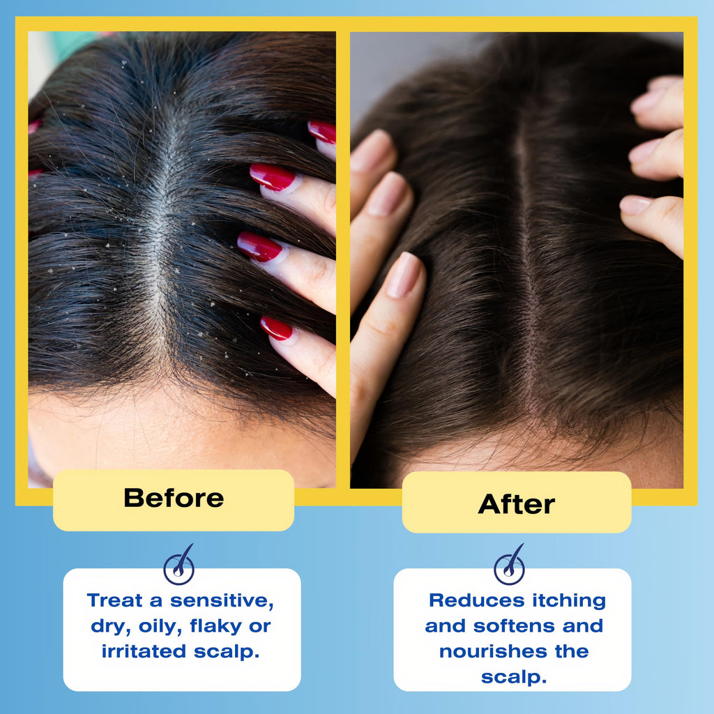 Mediceuticals Therapro Therapeutic Scalp Rinse – 33.8 Fl Oz