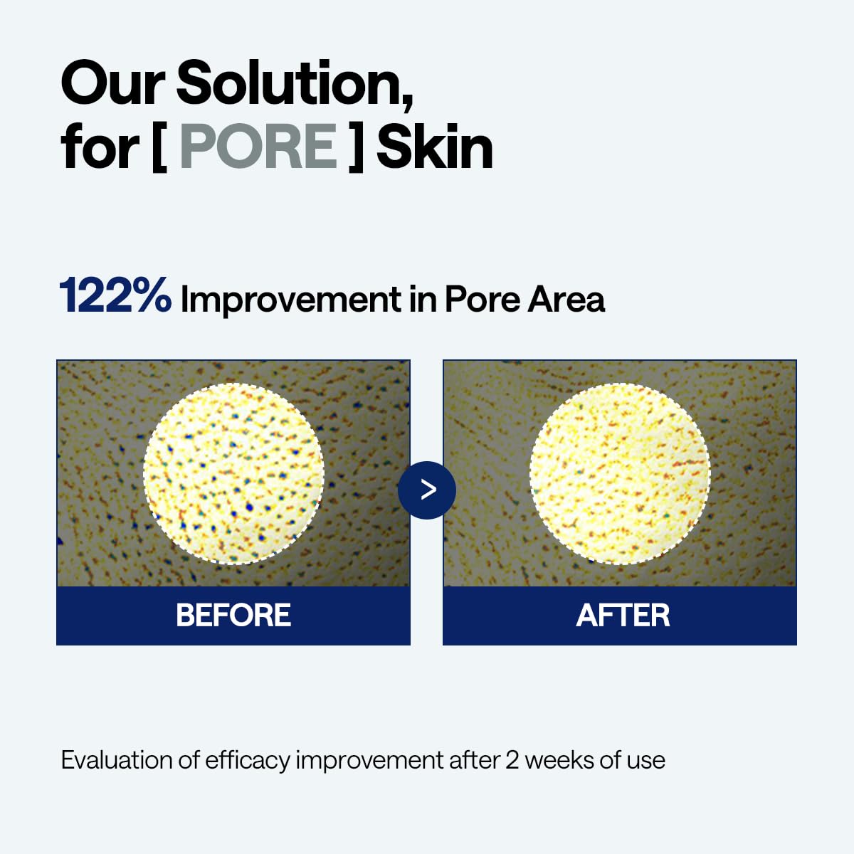 Mediheal Madecassoside Pore Repair Serum 1.35 fl oz | 2500 ppm Liposome Spicule & 98.5% Purity Madecassoside