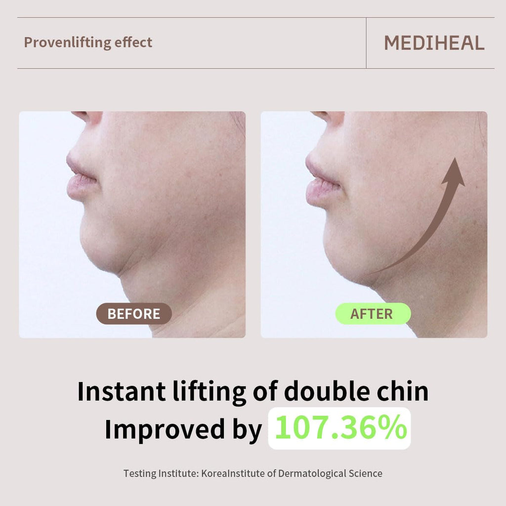 Mediheal Retinol Collagen Cream Lifting Mask – V Line & Anti-Aging (4 Counts)