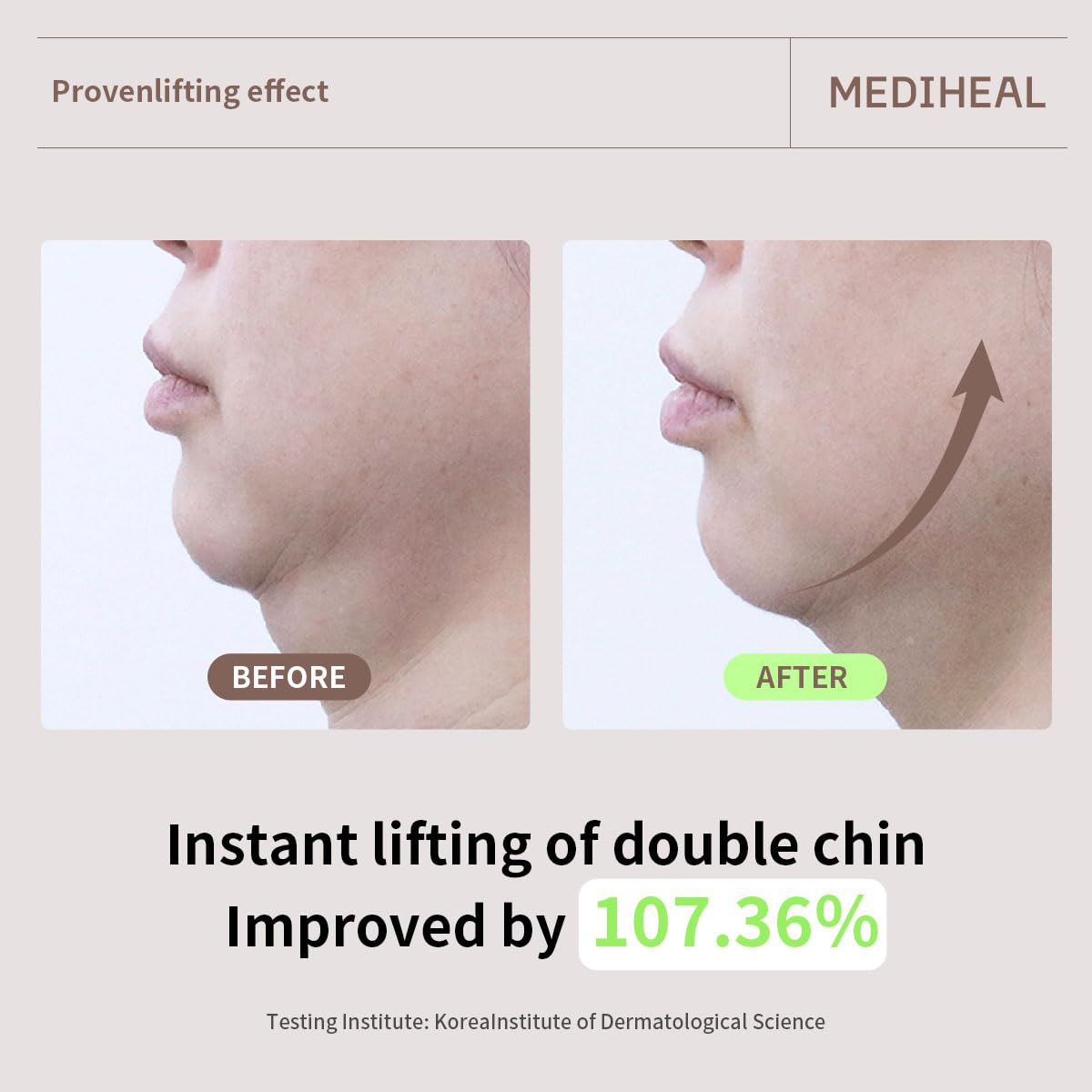 Mediheal Retinol Collagen Cream Lifting Mask – V Line & Anti-Aging (4 Counts)