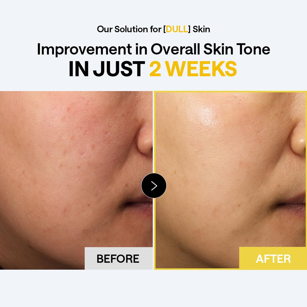 MEDIHEAL Toner Pads Vitamin C – Brightening, Niacinamide Blemish Care, 100 Count Vegan Pads