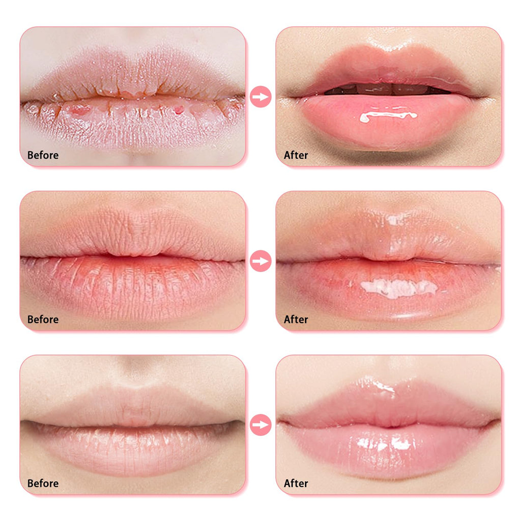 Meilury 3 Pcs Bee Lip Balm Honey Pot – Overnight Lip Mask Set (Honey, Strawberry, Watermelon)