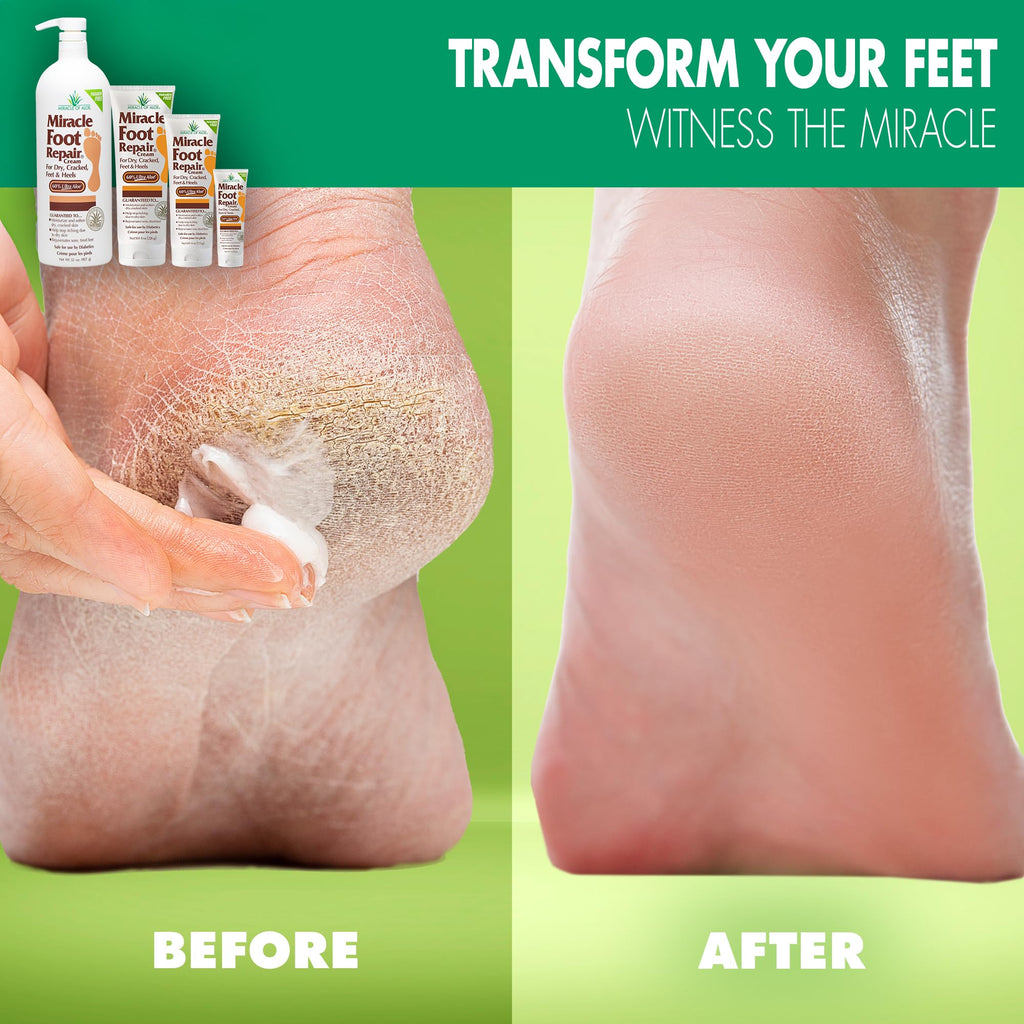 Miracle Foot Repair Cream – 60% Ultra Aloe, Diabetic-Safe, 2-Pack