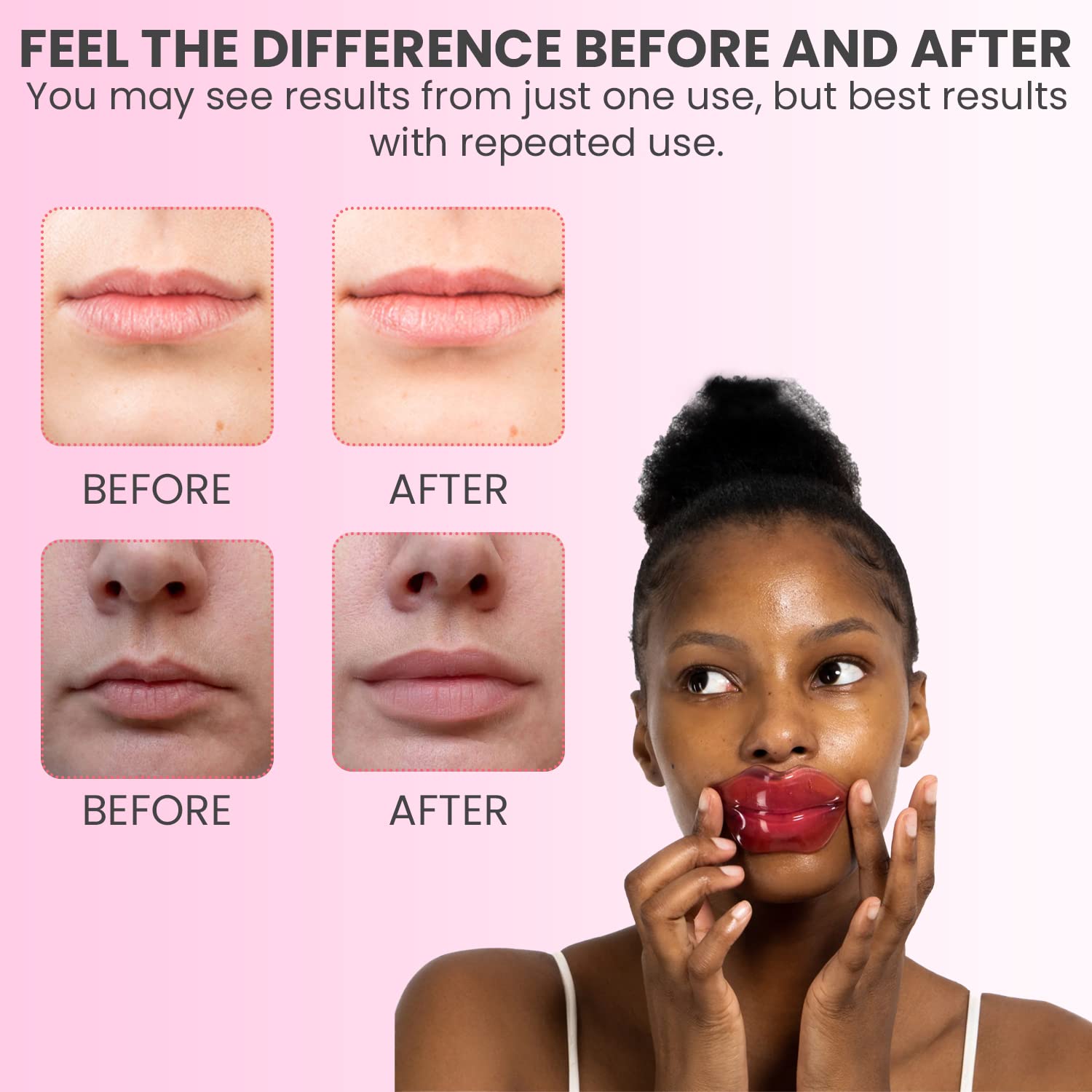 MISS SPA Lip Mask – Hydrate + Boost Hydrogel Lip Treatment (4 Pack)