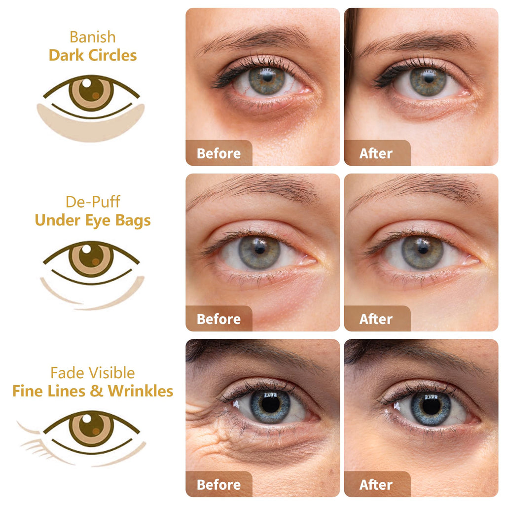 MLDWYH Under Eye Patches – 24K Gold, Hyaluronic Acid & Rose (30 Pairs)