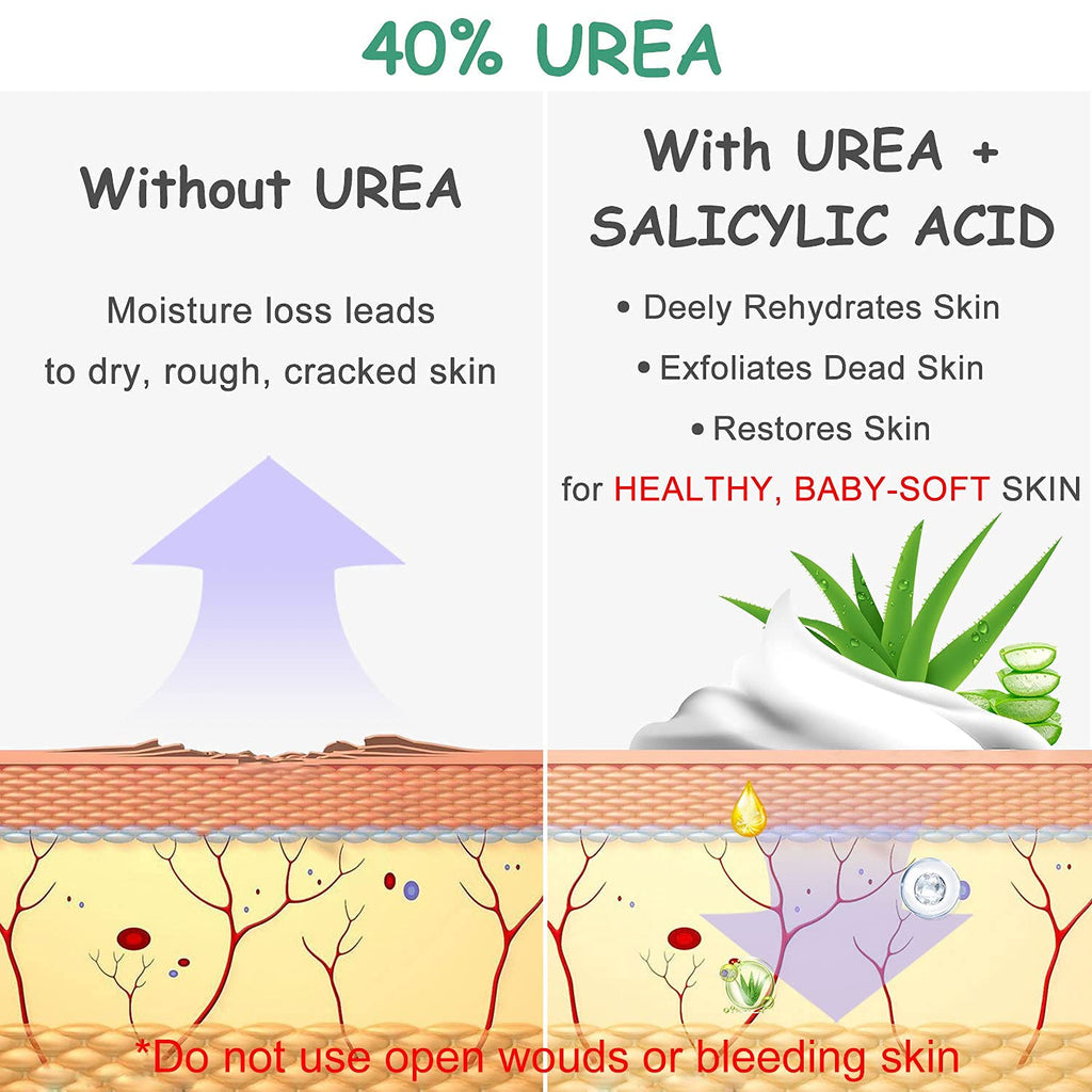 MOKYDUO Urea Cream 40% Foot Cream – Dry Skin & Cracked Heels (4.3 oz)