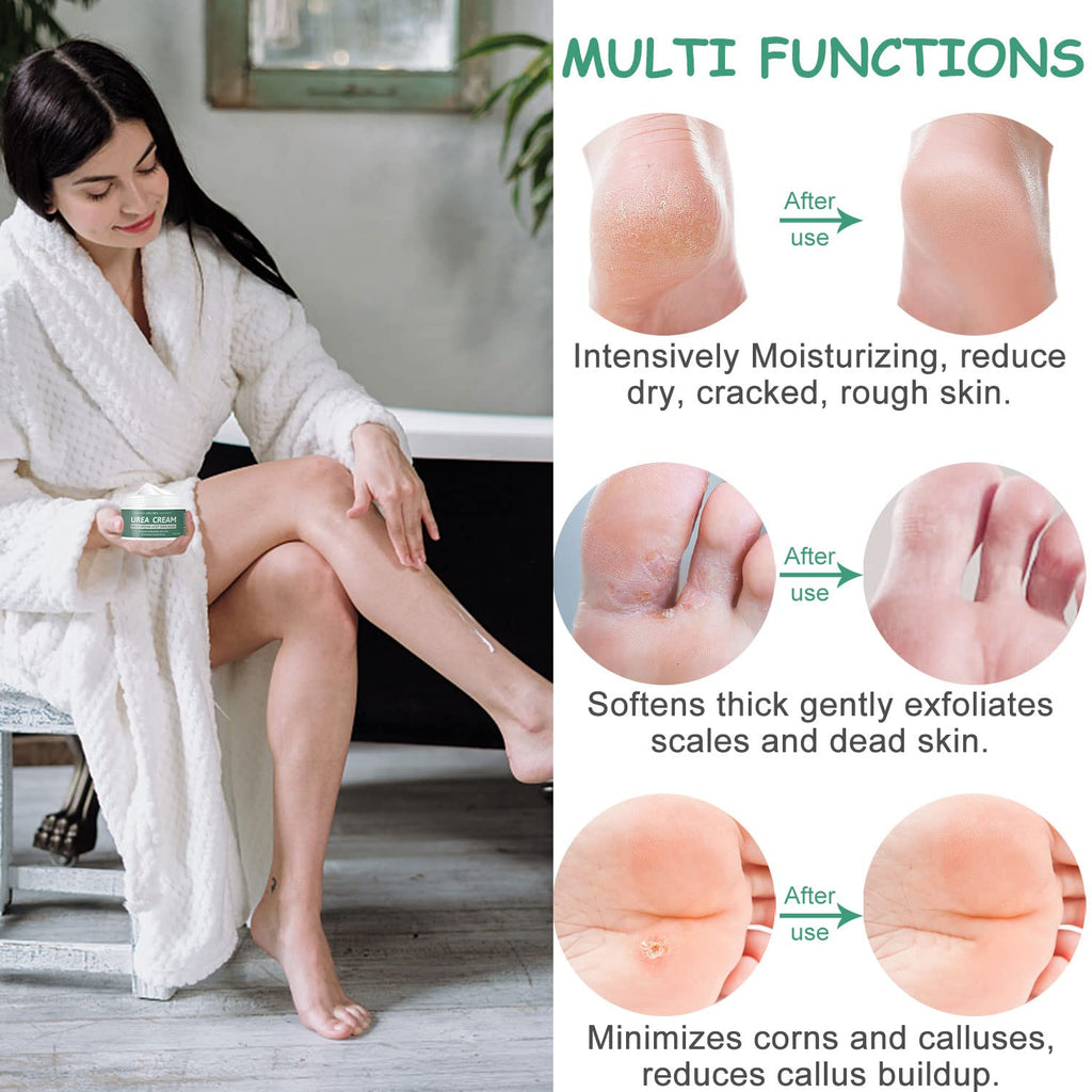 MOKYDUO Urea Cream 40% Foot Cream – Dry Skin & Cracked Heels (4.3 oz)