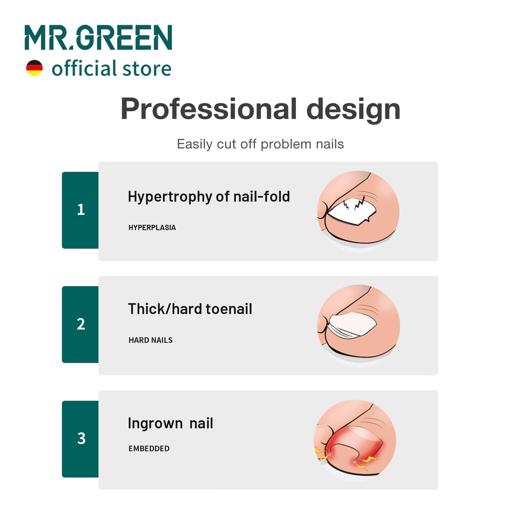 MR.GREEN Toenail Clippers – Stainless Steel Ingrown Nail Cutter for Thick, Hard Nails (Green)