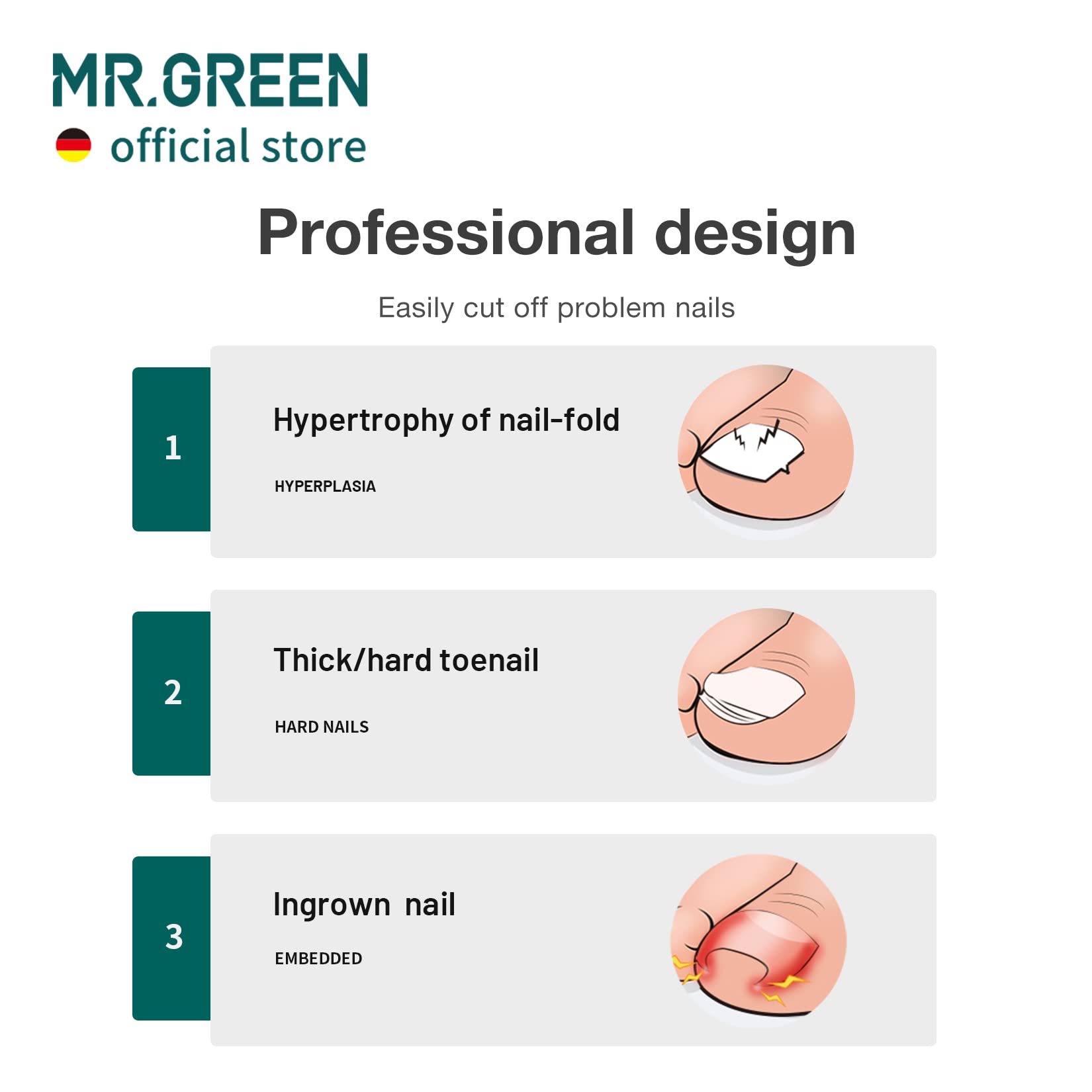 MR.GREEN Toenail Clippers – Stainless Steel Ingrown Nail Cutter for Thick, Hard Nails (Green)